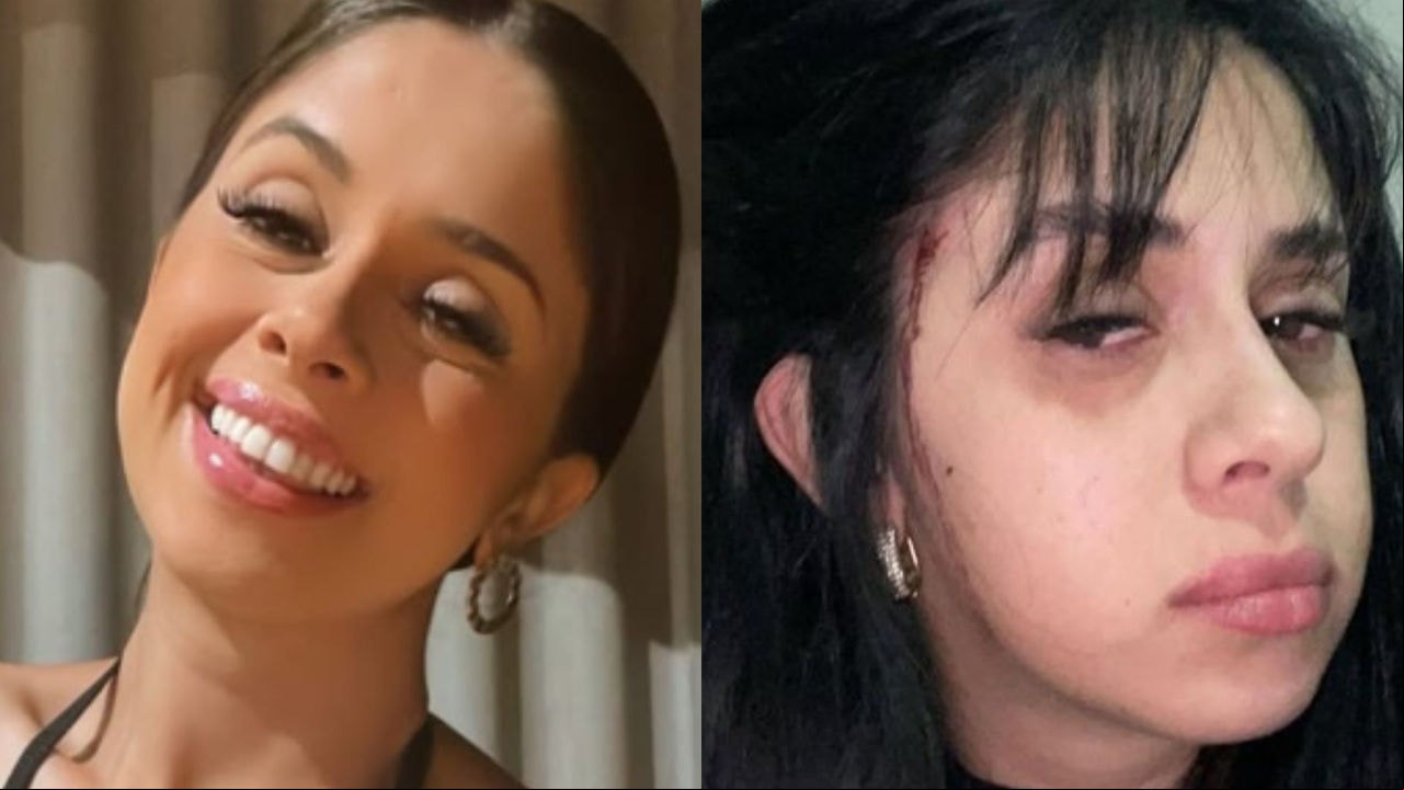 A cantora sertaneja Débora Amorim foi atacada e teve o cabelo cortado